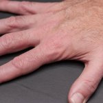 Budzi Cię mrowienie w palcach? Poranne drętwienie – przyczyny i szybkie sposoby ulgi